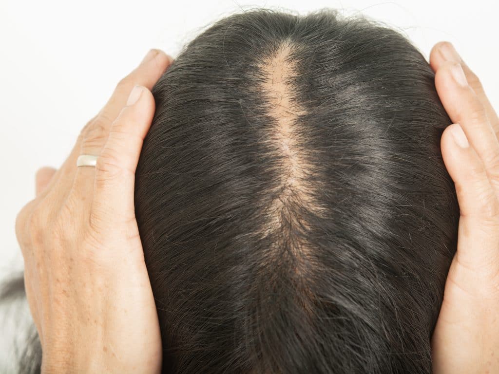 Dry Scalp treatment - Hair Cosmetica